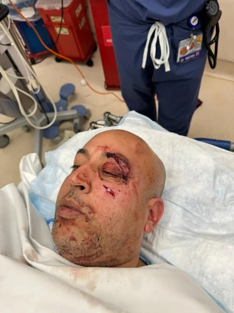 Gypsy Pichardo Teniente Dominicano del NYPD recibe una brutal paliza