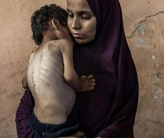 Gaza: duele en el alma